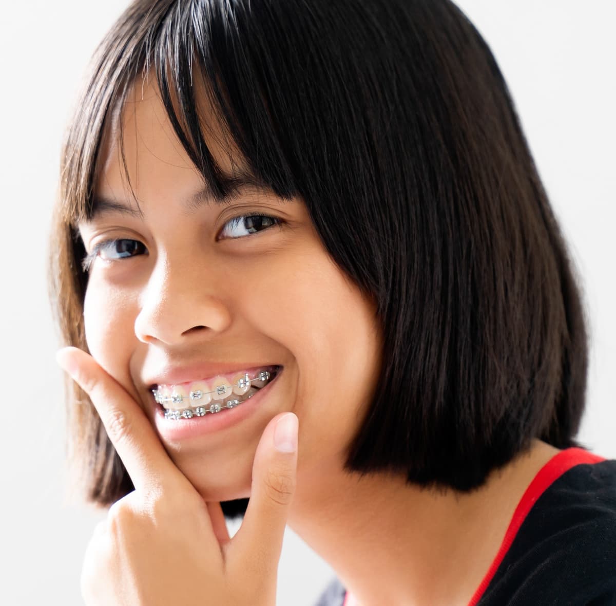Metal & Ceramic Braces