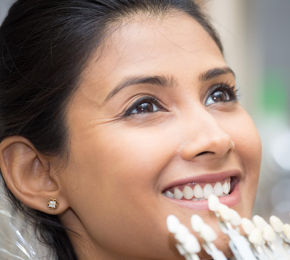 Tooth Restoration & Fillings