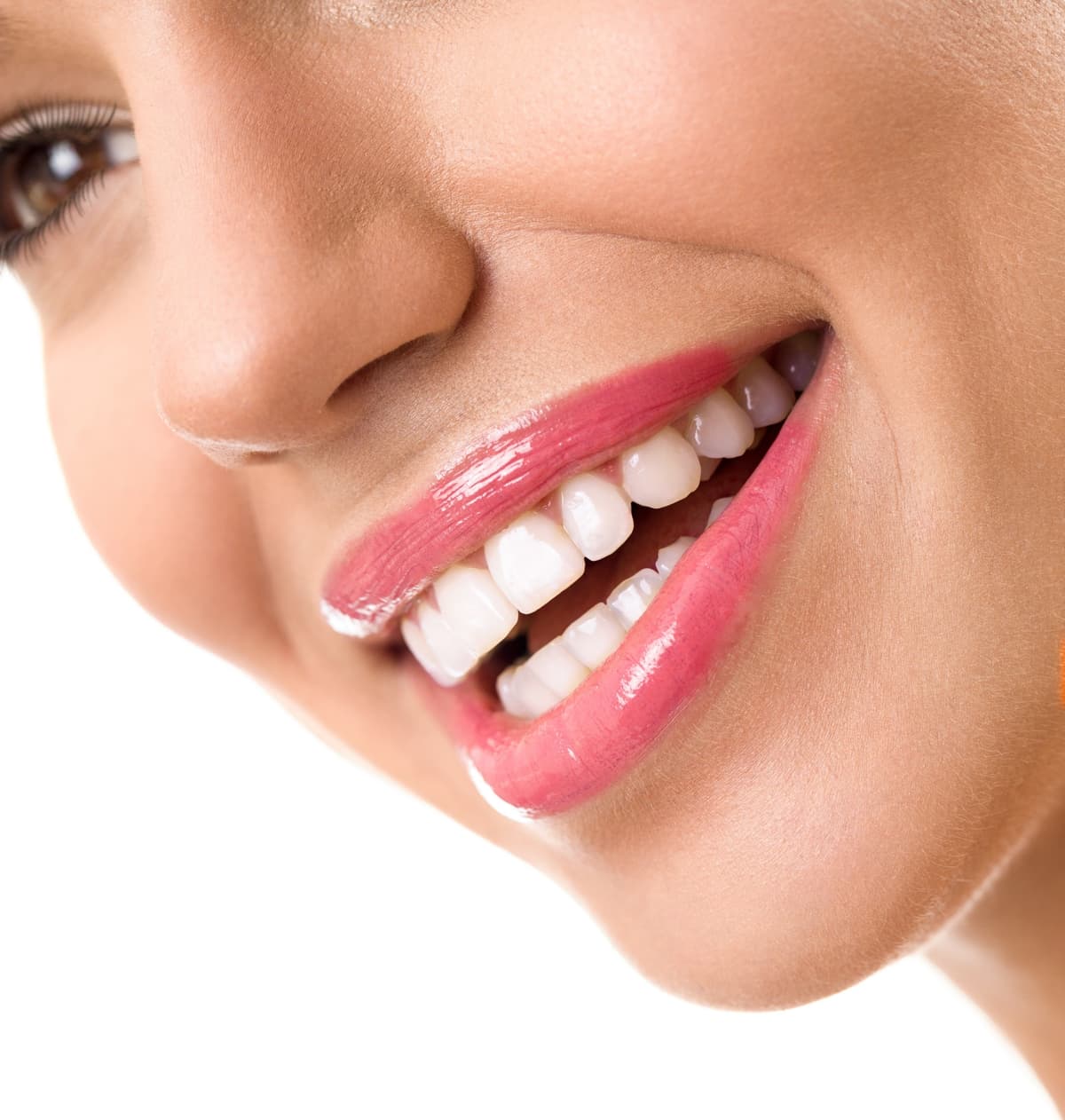 Smile Makeover