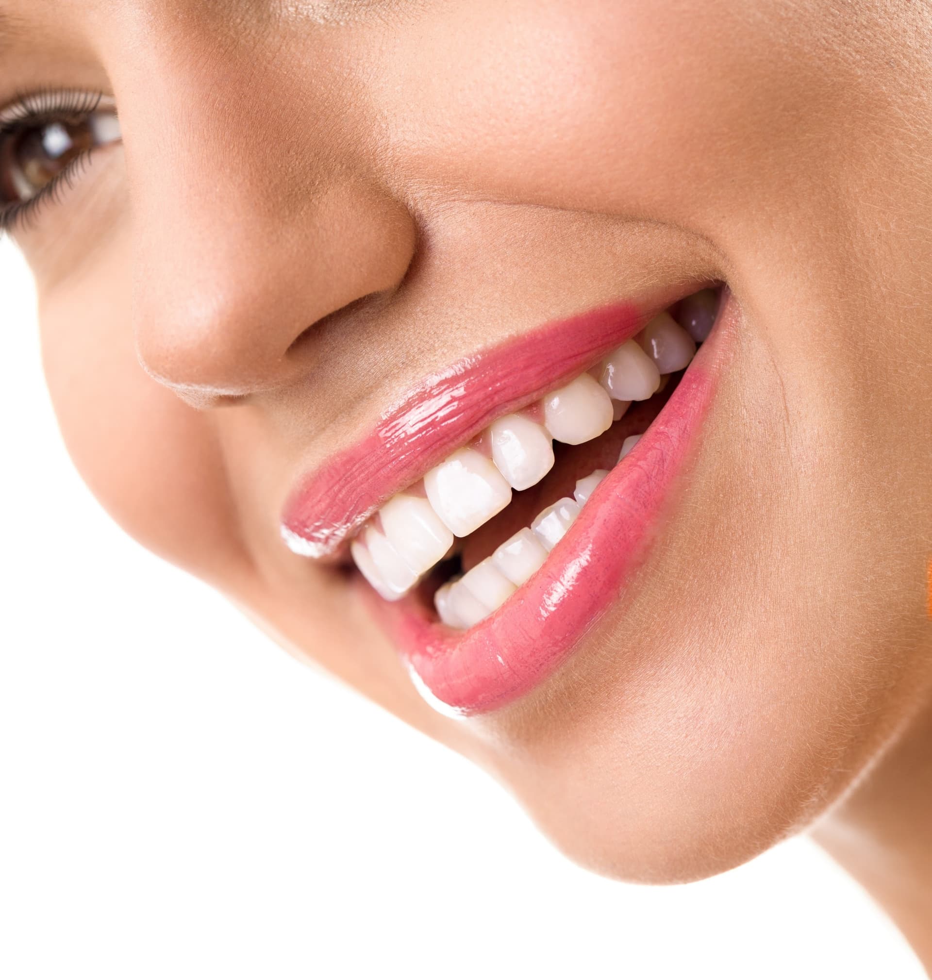 Smile Makeover
